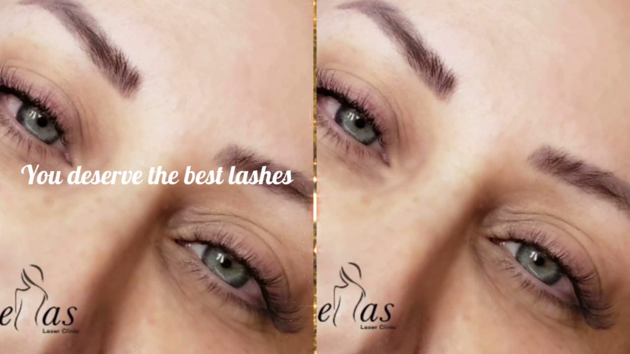 Ellas Laser Skin Clinic, photo 3