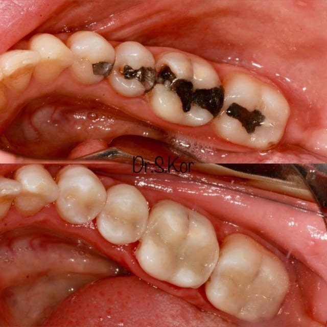 Russell Avenue Dental and Implant Centre - St Albans, photo 3