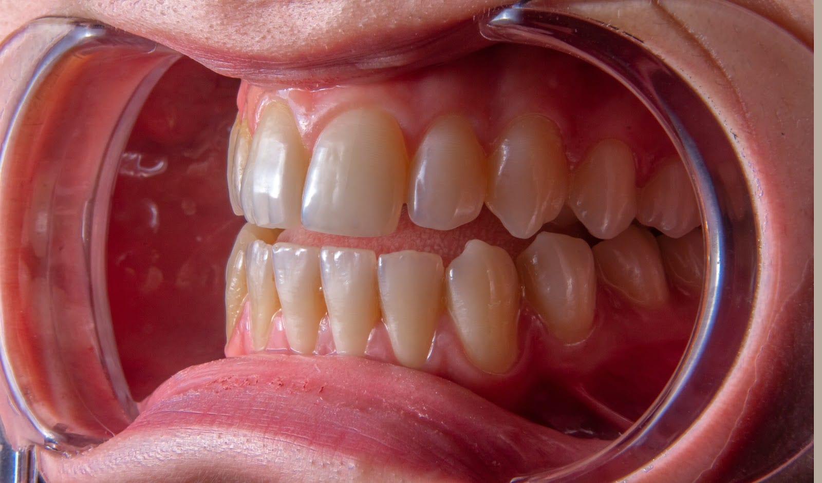 True Smile Dental, photo 2