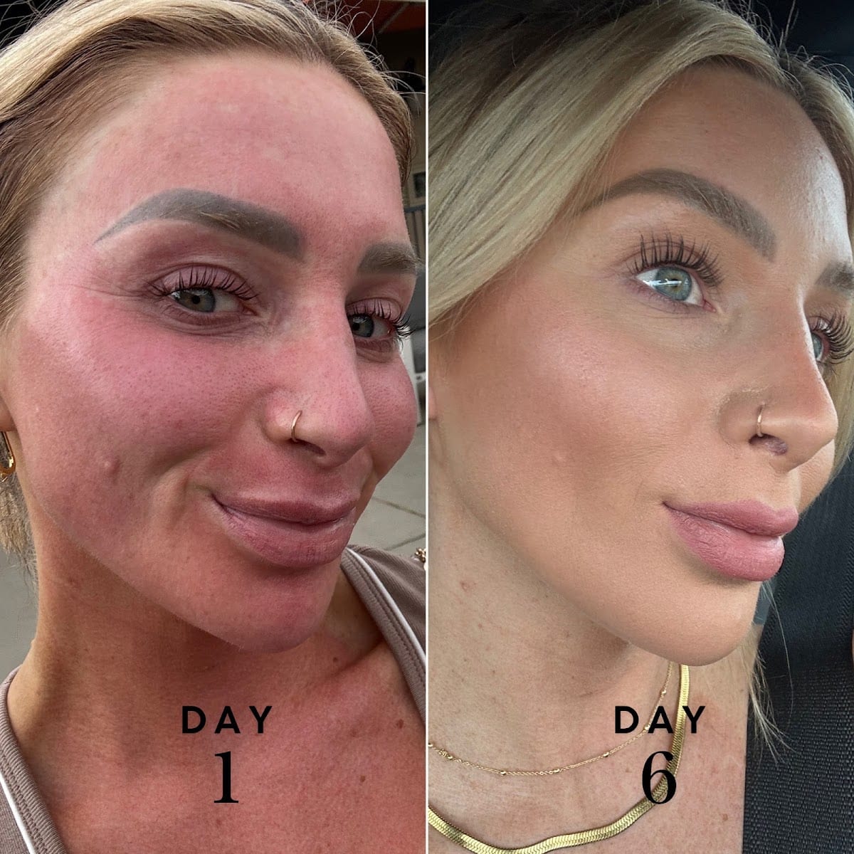 Precision Skin Services, photo 4