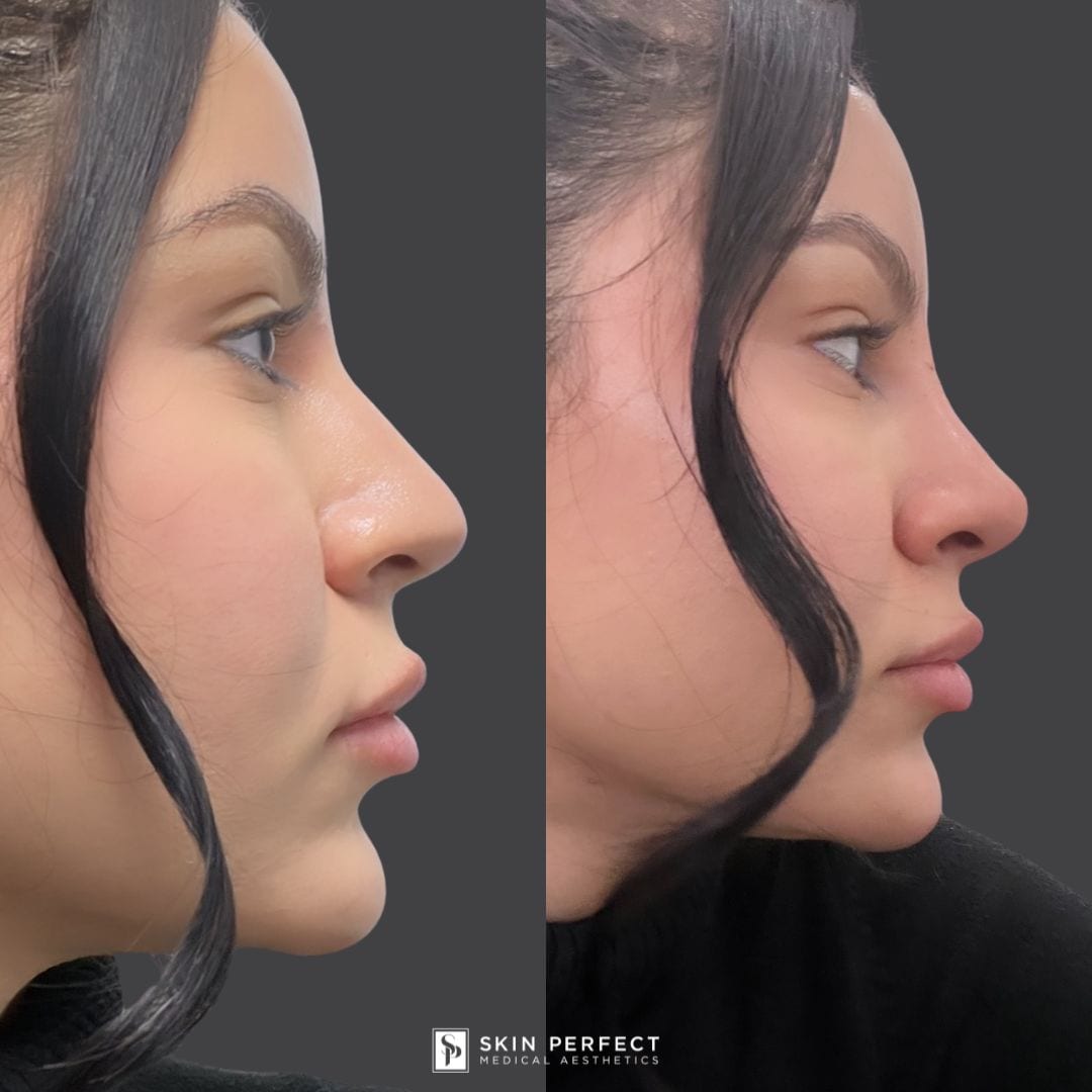 Skin Perfect Medical Aesthetics