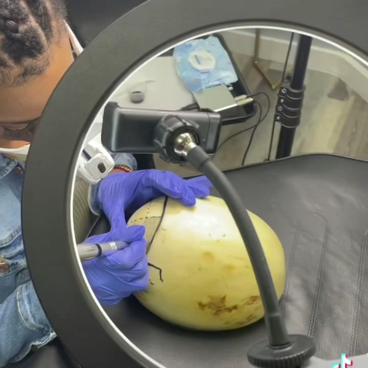Goscalp Scalp Micropigmentation Hair Loss Center, photo 3