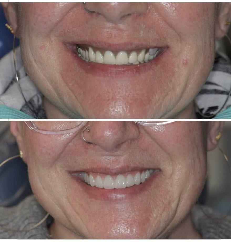 New Hope Digital Dentures, photo 2