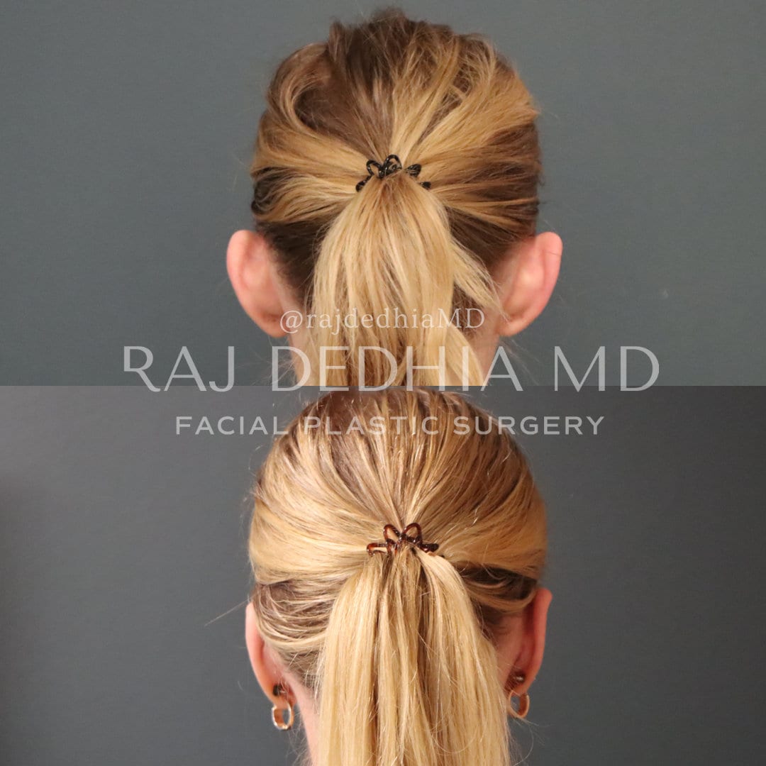 Raj Dedhia, MD Facial Plastic Surgery, photo 3