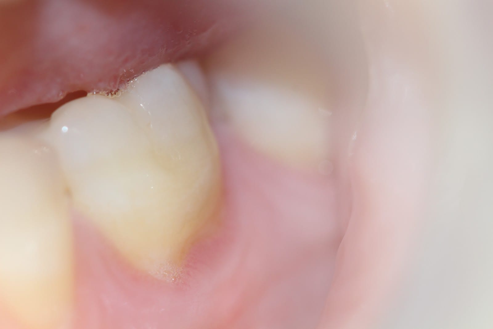 Leah Olson, DMD, Cosmetic and Family Dentistry, photo 3
