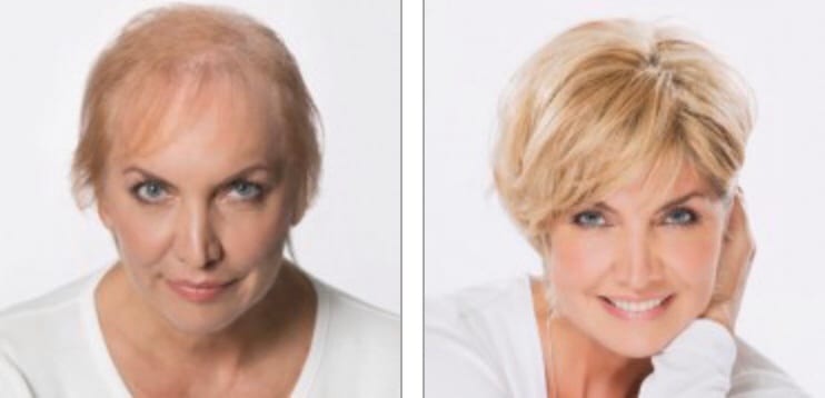 Beautiful Again Hair Replacement Salon, photo 3