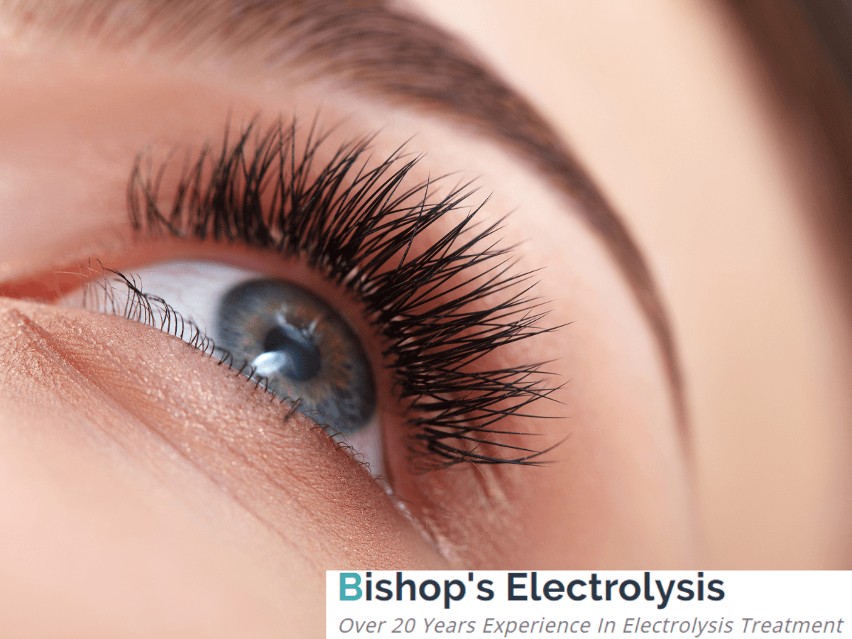 Bishop's Electrolysis, photo 4