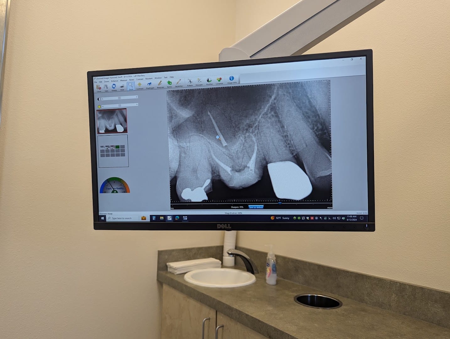 Fife and Steffen Endodontics, photo 4